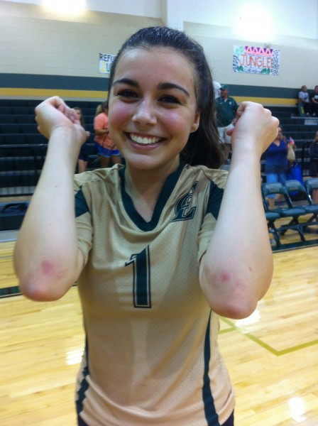 Libero Sam York showing off those floor burns after win over La Vernia